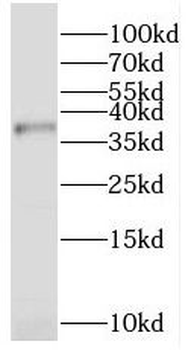 PEX2 Rabbit Polyclonal Antibody