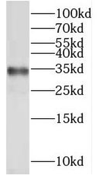 PYCR1 Rabbit Polyclonal Antibody