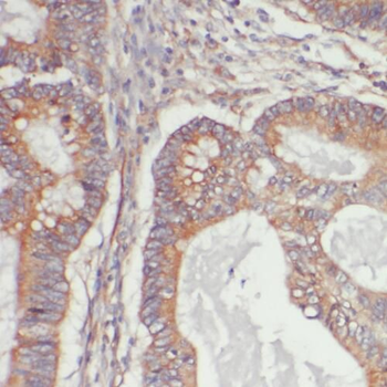PYCR1 Rabbit Polyclonal Antibody