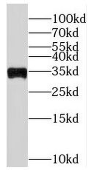 PYCR2 Rabbit Polyclonal Antibody