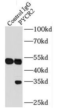PYCR2 Rabbit Polyclonal Antibody
