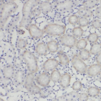 PYCR2 Rabbit Polyclonal Antibody