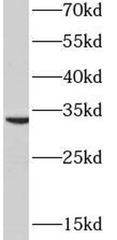 PYCR2 Rabbit Polyclonal Antibody