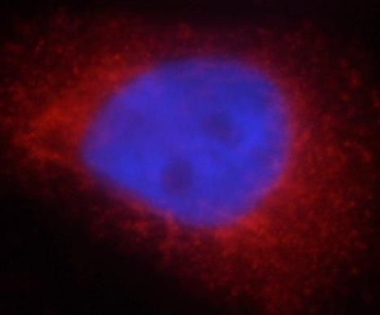 PYCR2 Rabbit Polyclonal Antibody