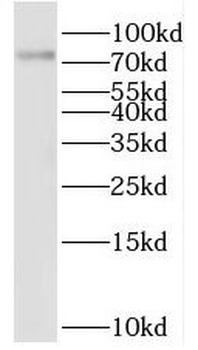 QSOX1 Rabbit Polyclonal Antibody