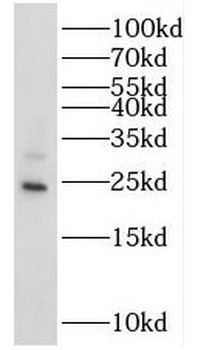 RAB14 Rabbit Polyclonal Antibody