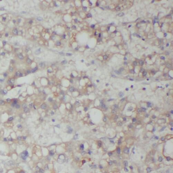 RAB14 Rabbit Polyclonal Antibody