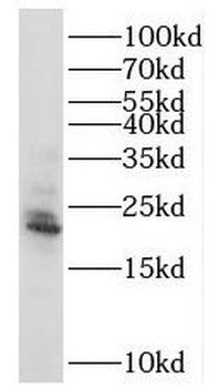 RAB18 Rabbit Polyclonal Antibody