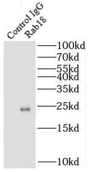 RAB18 Rabbit Polyclonal Antibody