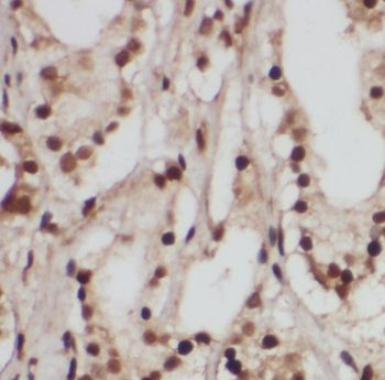 RAB18 Rabbit Polyclonal Antibody