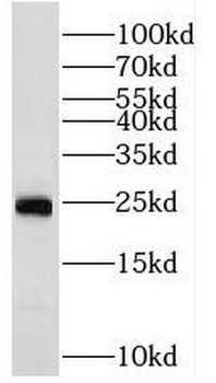 RAB2A Rabbit Polyclonal Antibody