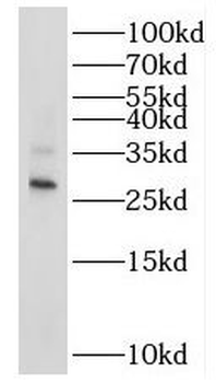 RAB20 Rabbit Polyclonal Antibody