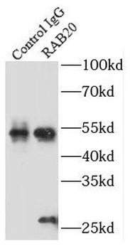 RAB20 Rabbit Polyclonal Antibody