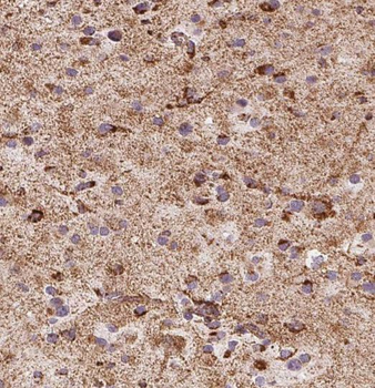 RAB22A Rabbit Polyclonal Antibody