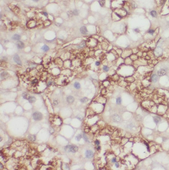 RAB23 Rabbit Polyclonal Antibody