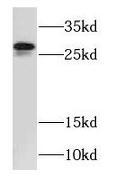 RAB26 Rabbit Polyclonal Antibody