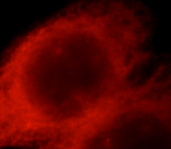 RAB27A Mouse Monoclonal Antibody