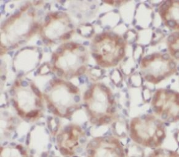 RAB27A Mouse Monoclonal Antibody