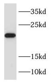 RAB31 Rabbit Polyclonal Antibody