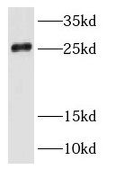 RAB35 Antibody
