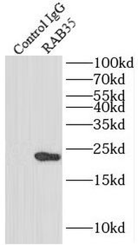 RAB35 Antibody