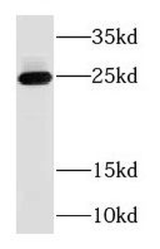 RAB3B Rabbit Polyclonal Antibody