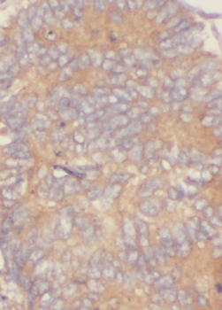 RAB3B Rabbit Polyclonal Antibody