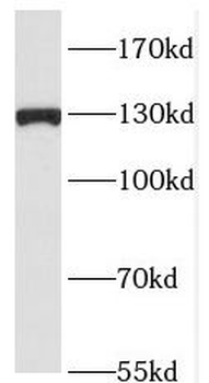 RAB3GAP1 Antibody