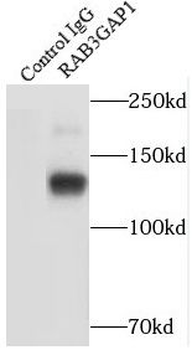 RAB3GAP1 Antibody
