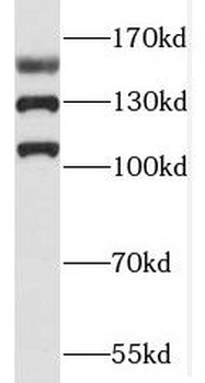 RAB3GAP2 Rabbit Polyclonal Antibody