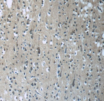 RAB3GAP2 Rabbit Polyclonal Antibody