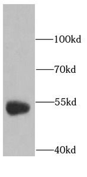 RAB3IP Rabbit Polyclonal Antibody