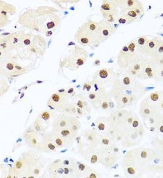 RAB3IP Rabbit Polyclonal Antibody