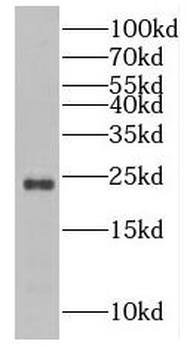 RAB43 Rabbit Polyclonal Antibody