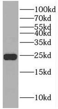 RAB6B Rabbit Polyclonal Antibody