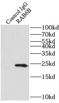 RAB6B Rabbit Polyclonal Antibody