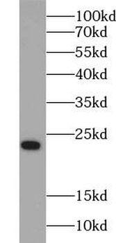 RAB8A Rabbit Polyclonal Antibody