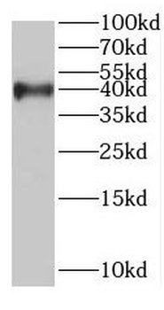 RABEPK Rabbit Polyclonal Antibody