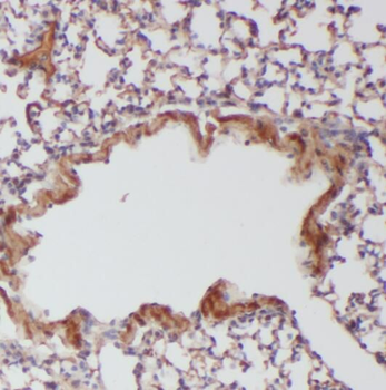 RABGGTA Rabbit Polyclonal Antibody