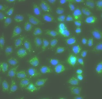 RAC1 Rabbit Polyclonal Antibody