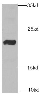 RAC2 Rabbit Polyclonal Antibody