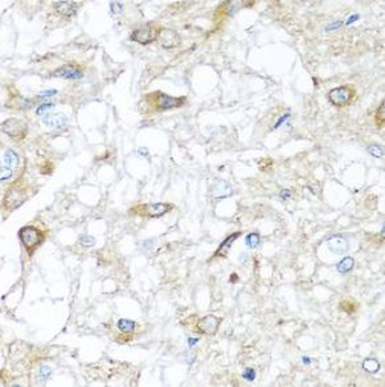 RAC2 Rabbit Polyclonal Antibody