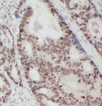 RACGAP1 Rabbit Polyclonal Antibody