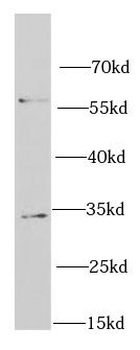RACK1 Antibody