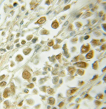 RAD23A Rabbit Polyclonal Antibody