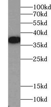 RAD51 Rabbit Polyclonal Antibody