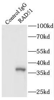RAD51 Rabbit Polyclonal Antibody