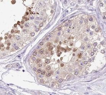 RAD51 Rabbit Polyclonal Antibody