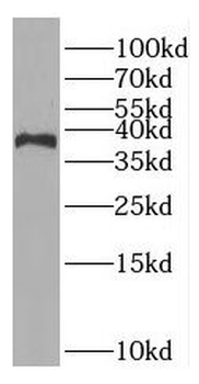 Rad51ap1 Rabbit Polyclonal Antibody