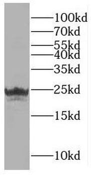 RAD51D Rabbit Polyclonal Antibody